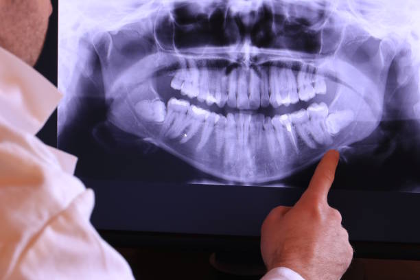Best Emergency Treatment for Toothache in Ellsworth, ME