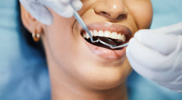 Best Emergency Tooth Extraction in Ellsworth, ME