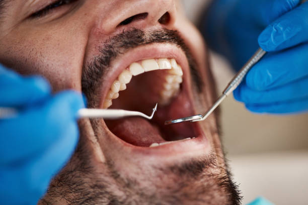 Fast & Reliable Emergency Dental Services in ME